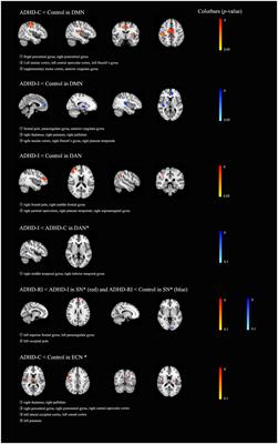 The clinical, neuropsychological, and brain functional characteristics of the ADHD restrictive inattentive presentation